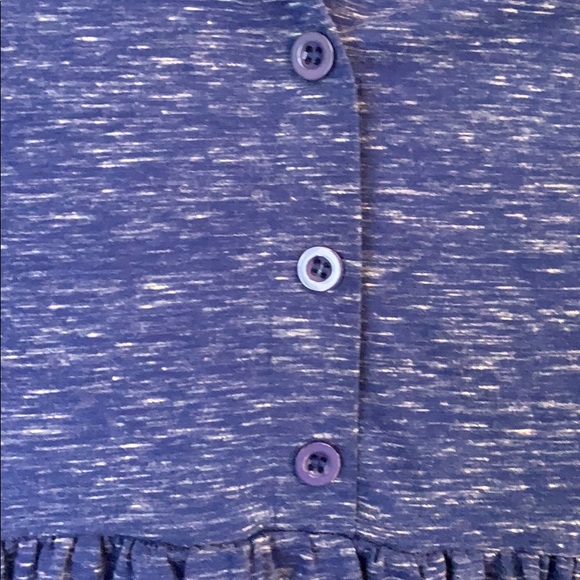 Blue button tunic - Picture 2 of 5